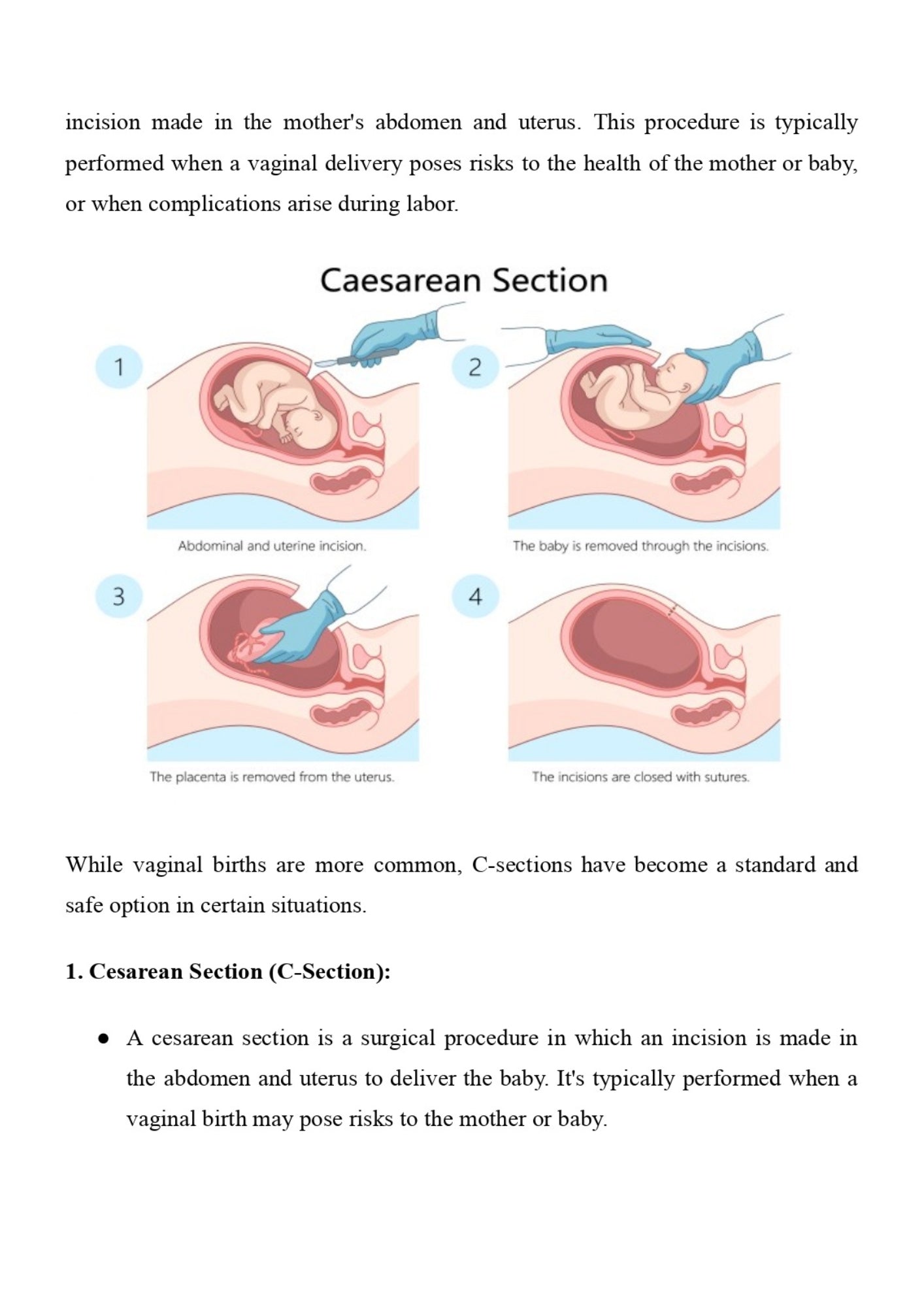 Pregnancy and Birth for Newbies